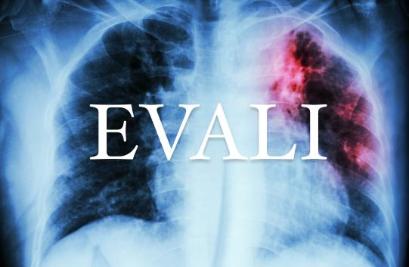 Чем опасен вейп? Узнали у врача-психиатра-нарколога.