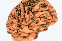 Влияние алкоголя на нервную систему